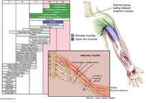 Brachial Plexus Anatomy Diagram, Erb's palsy Injury, Anatomy of Brachial Plexus