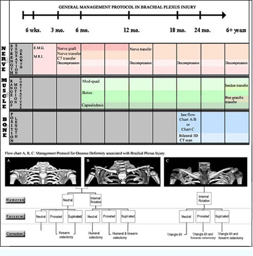 Brachial Plexus Injuries Chart