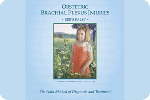 Obstetric Brachial Plexus Injuries