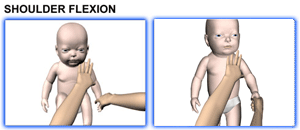 Brachial Plexus and erbs palsy - Baby Range of motion - Shoulder Flexion