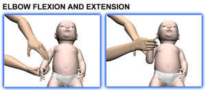Brachial Plexus and erbs palsy - Baby Range of motion - Elbow Flexion
