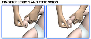 Brachial Plexus and erbs palsy - Baby Range of motion - Finger Flexion