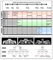 Decision Tree for Treatment and Care