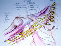 Brachial Plexus Injury and Reconstructive Surgery Diagram